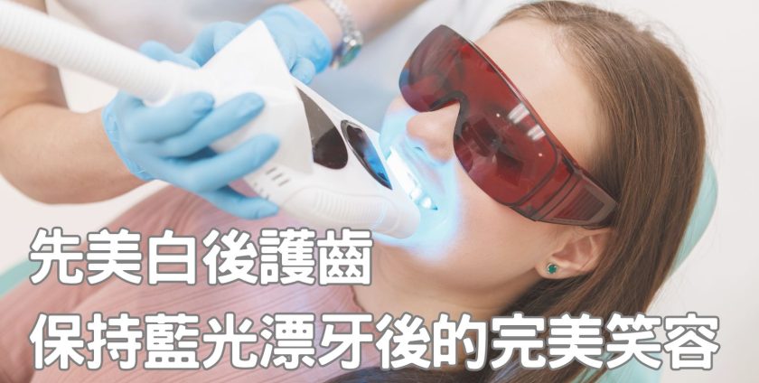 《Stars HK》報導：先美白後護齒 保持藍光漂牙後的完美笑容